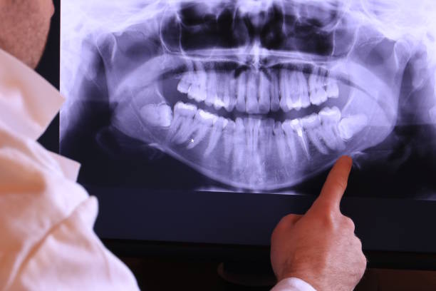 Best Emergency Dentist for Knocked-Out Tooth in San Ramon, CA