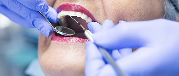 Best Orthodontic Emergency Dentist in San Ramon, CA